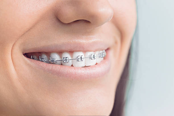 Best Full Mouth Reconstruction  in Gumlog, GA